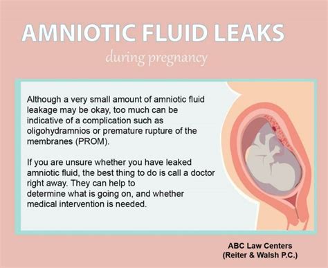 small amount of amniotic fluid leak|Leaking Amniotic Fluid: Signs, Causes, and。